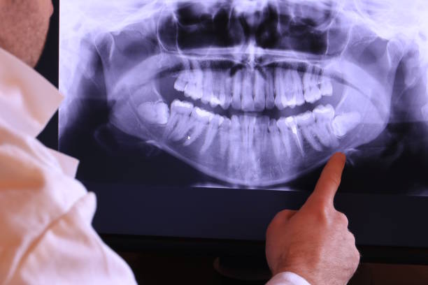 Best Dentist for Tooth Abscess  in Heritage Pines, FL